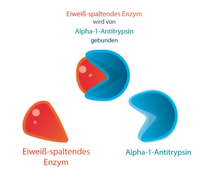 Was ist der Alpha-1-Antitrypsin-Mangel? Antworten hier!