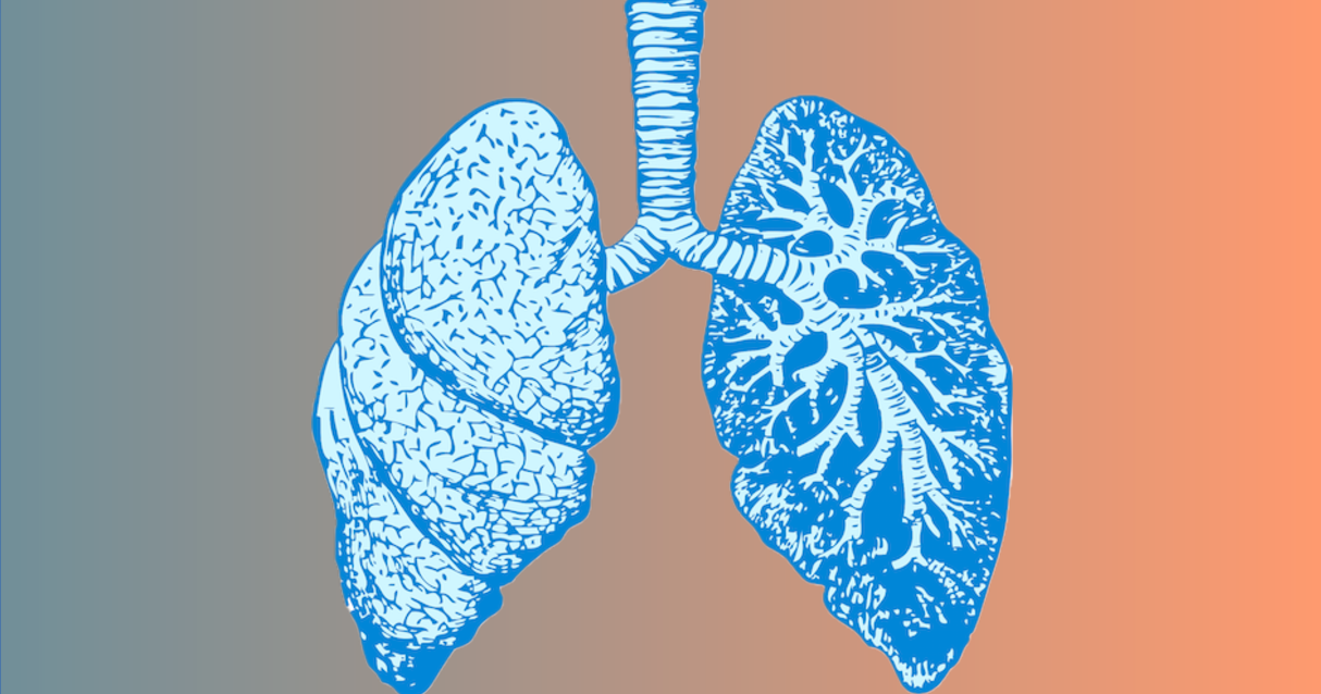 Neue Leitlinie zur Nachsorge nach Lungentransplantation