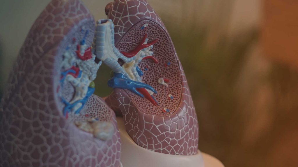 Plastisches Modell einer Lunge