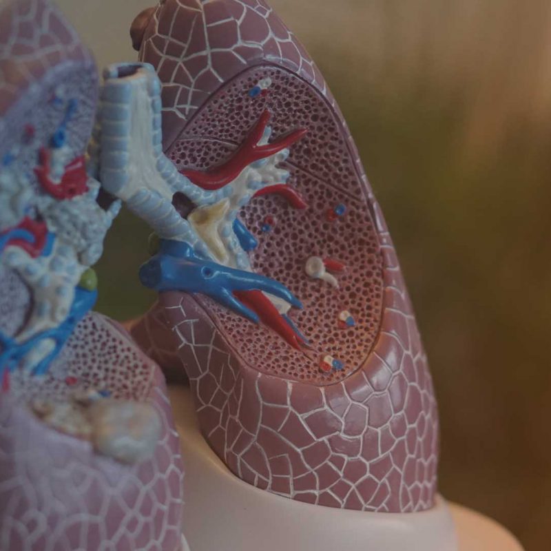 Plastisches Modell einer Lunge