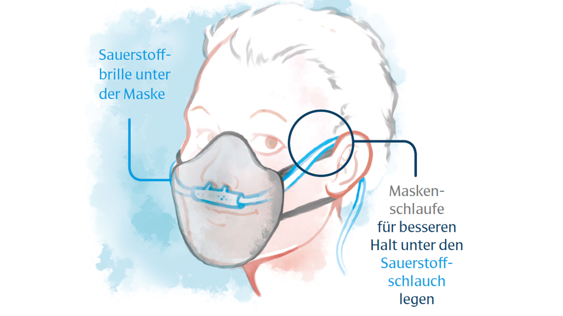 Illustration einer Person mit Sauerstoffmaske und Mund-Nasen-Schutz